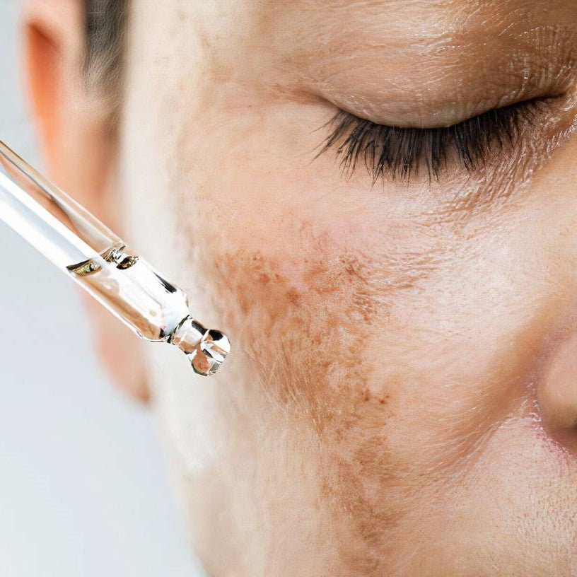 Чи можна використовувати сироватки з вітаміном З літом?