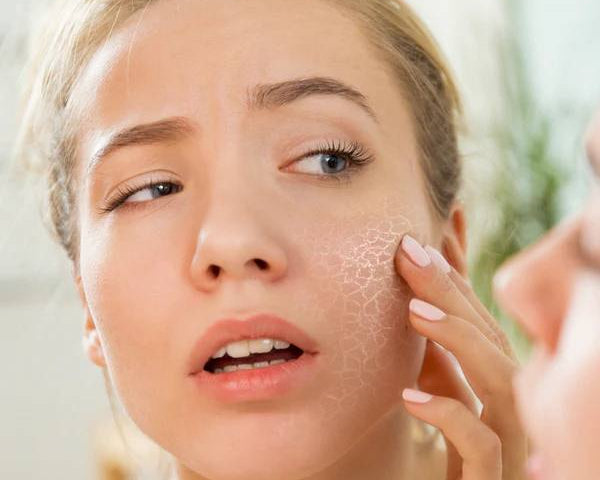 Як доглядати за сухою шкірою